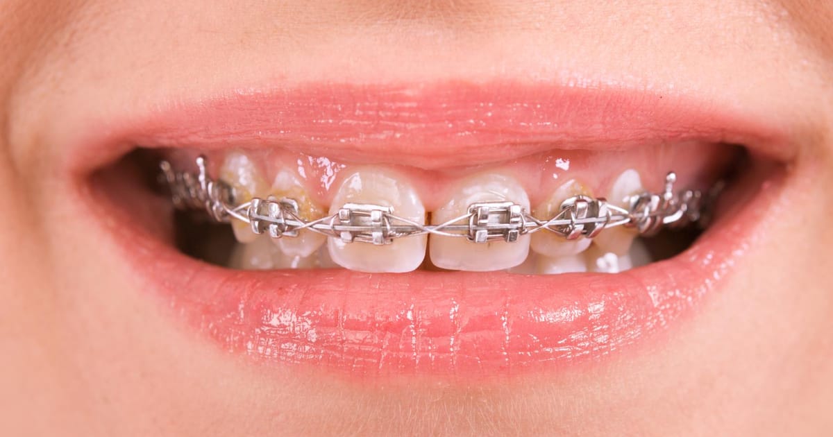 Apt Orthodontics Virginia about.me