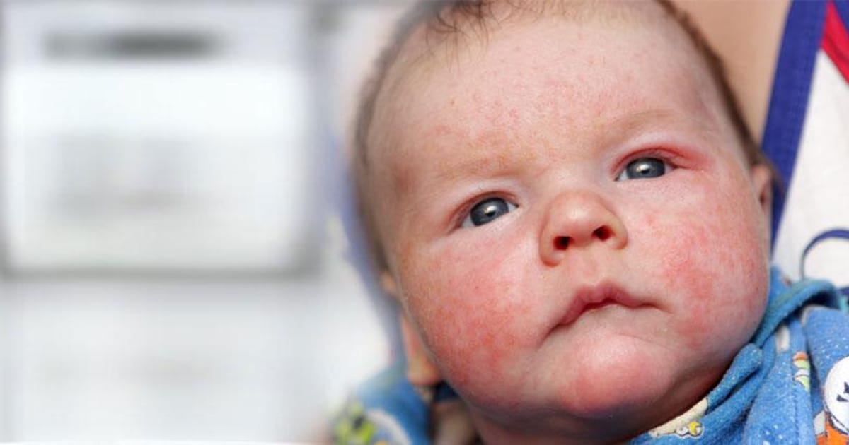 Allergy doctors North Melborne, Specialist Consultin Room, 550