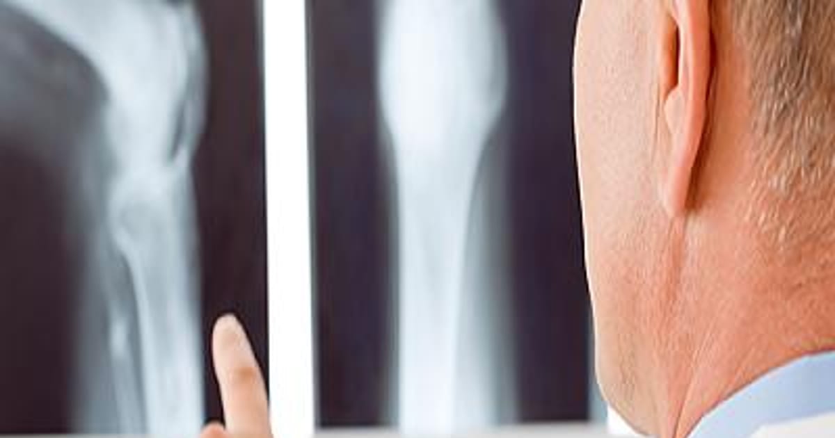 Jason Fond Nanuet,NY,USA, Assistant Professor and Physician Domician