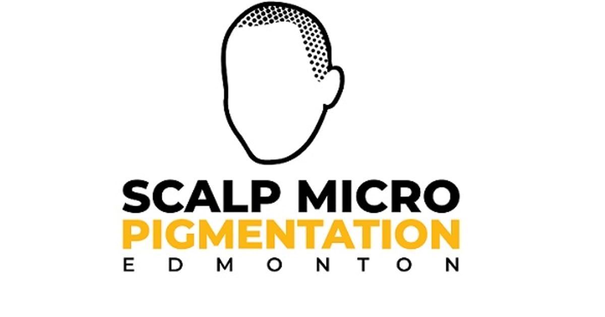SCALPMICRO SCALP MICROPIGMENTATION EDMONTON about.me