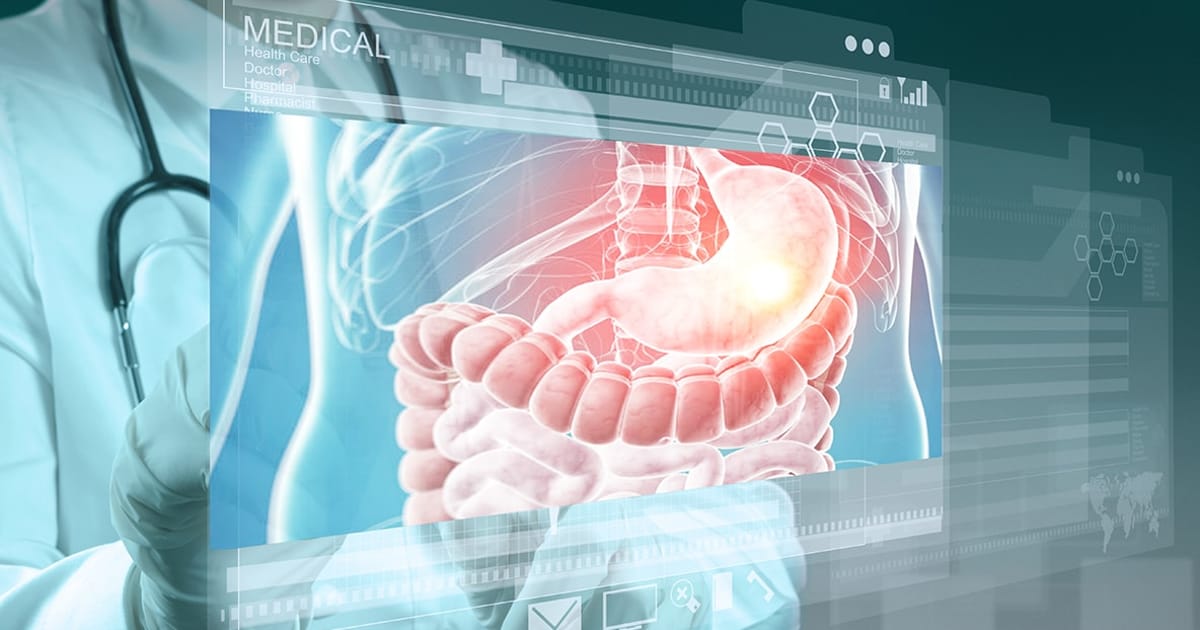 WHAT IS A GASTROENTEROLOGIST visual data 2